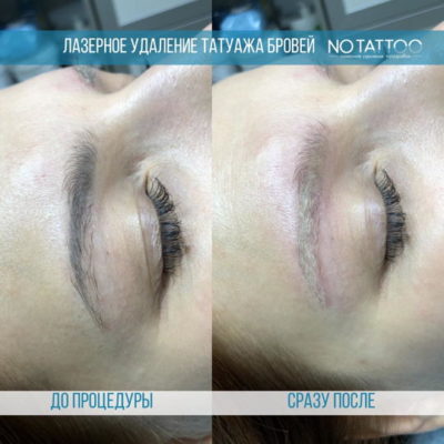 IMG_1895