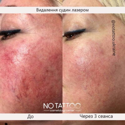Image-2